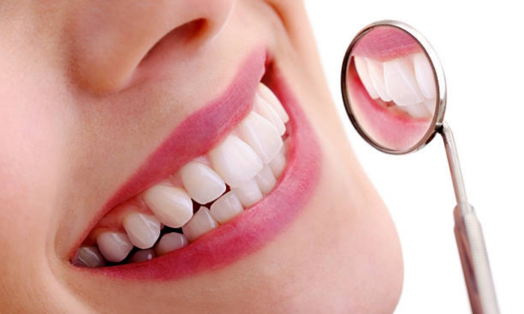 Full Mouth Rehabilitation