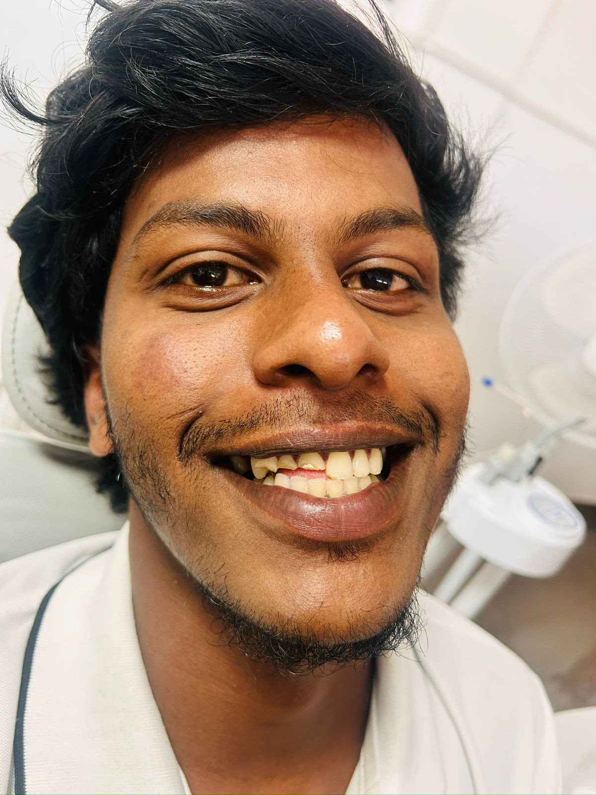 After smile transformation 1