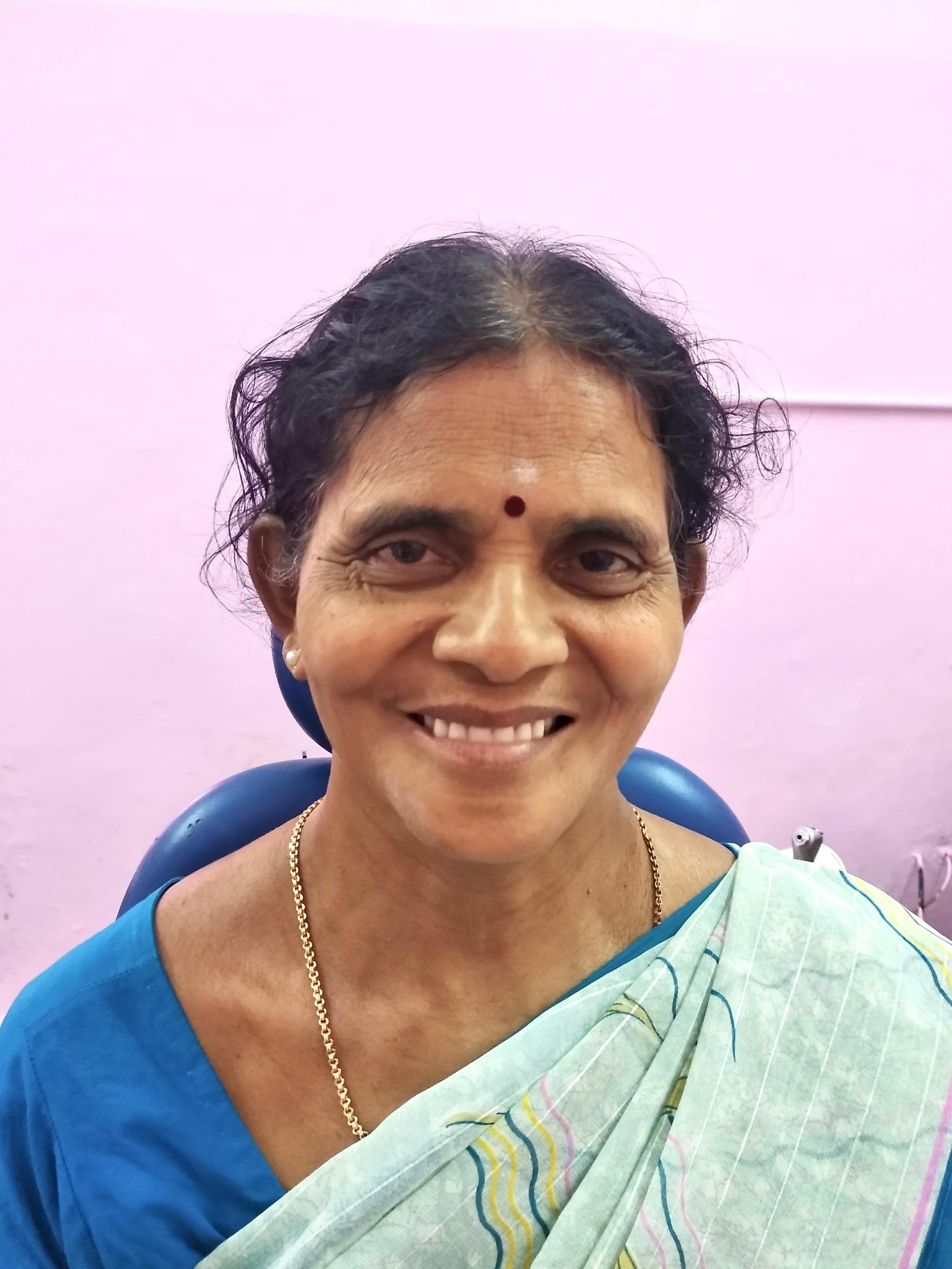 After smile transformation 4